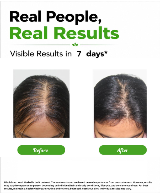 KESH Herbal Hair Oil Bottle