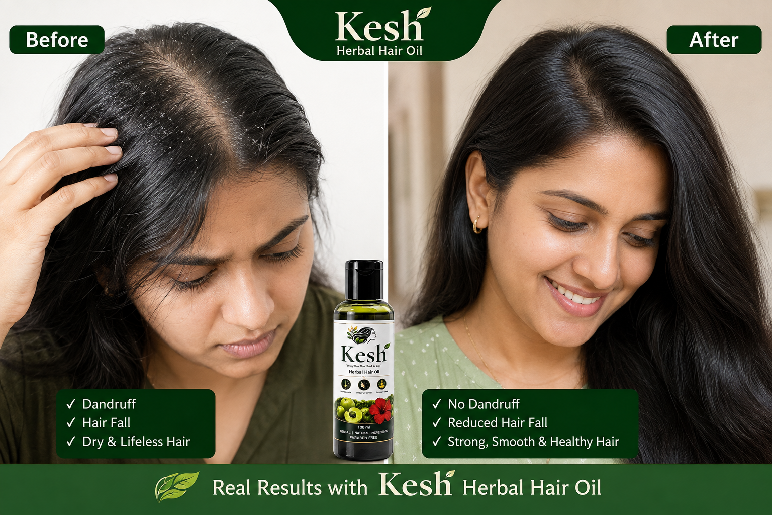 Before and After using KESH Herbal Hair Oil - Dandruff to no dandruff, hair fall to strong hair