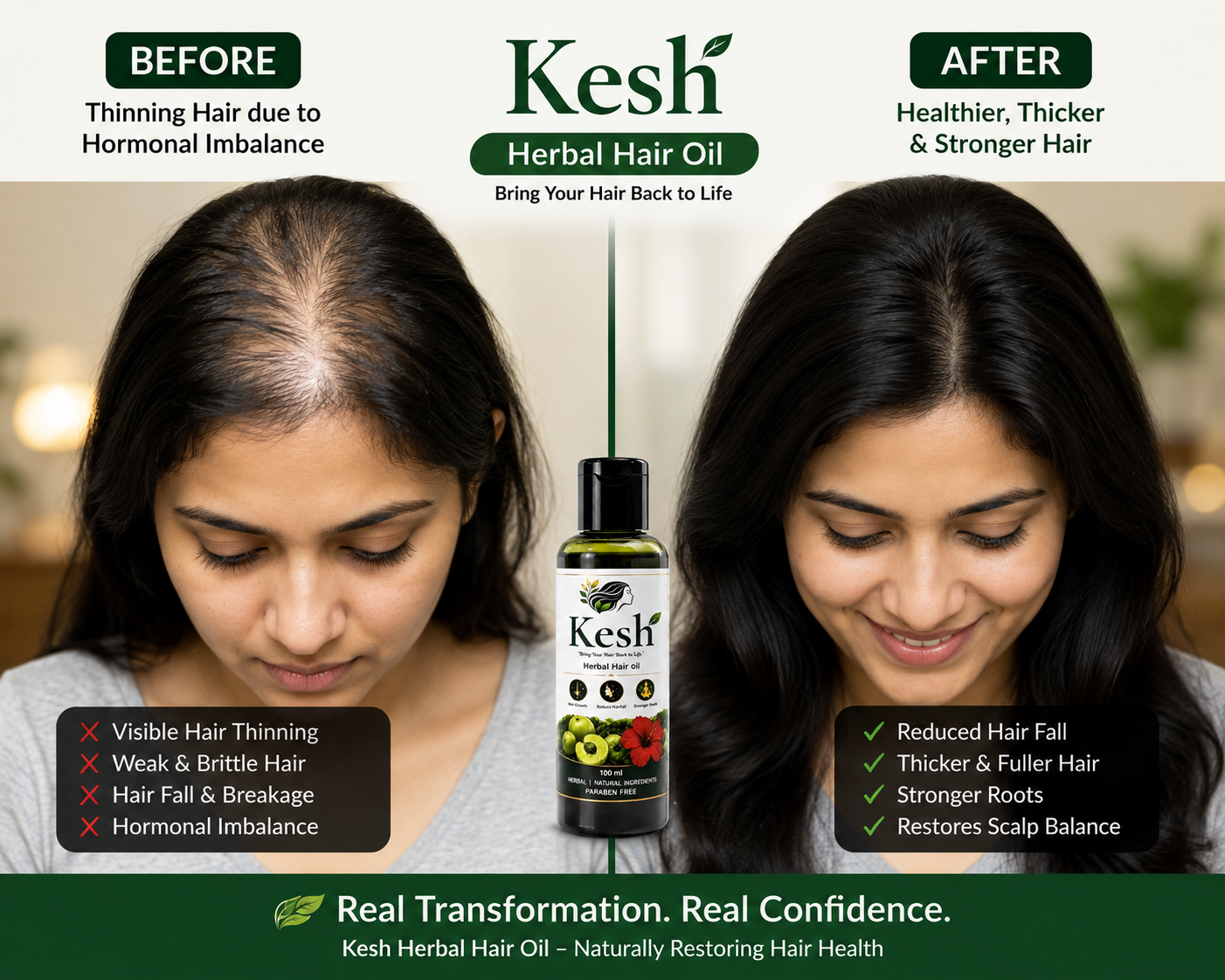 Before and After using KESH Herbal Hair Oil - Thinning hair to thicker, stronger hair